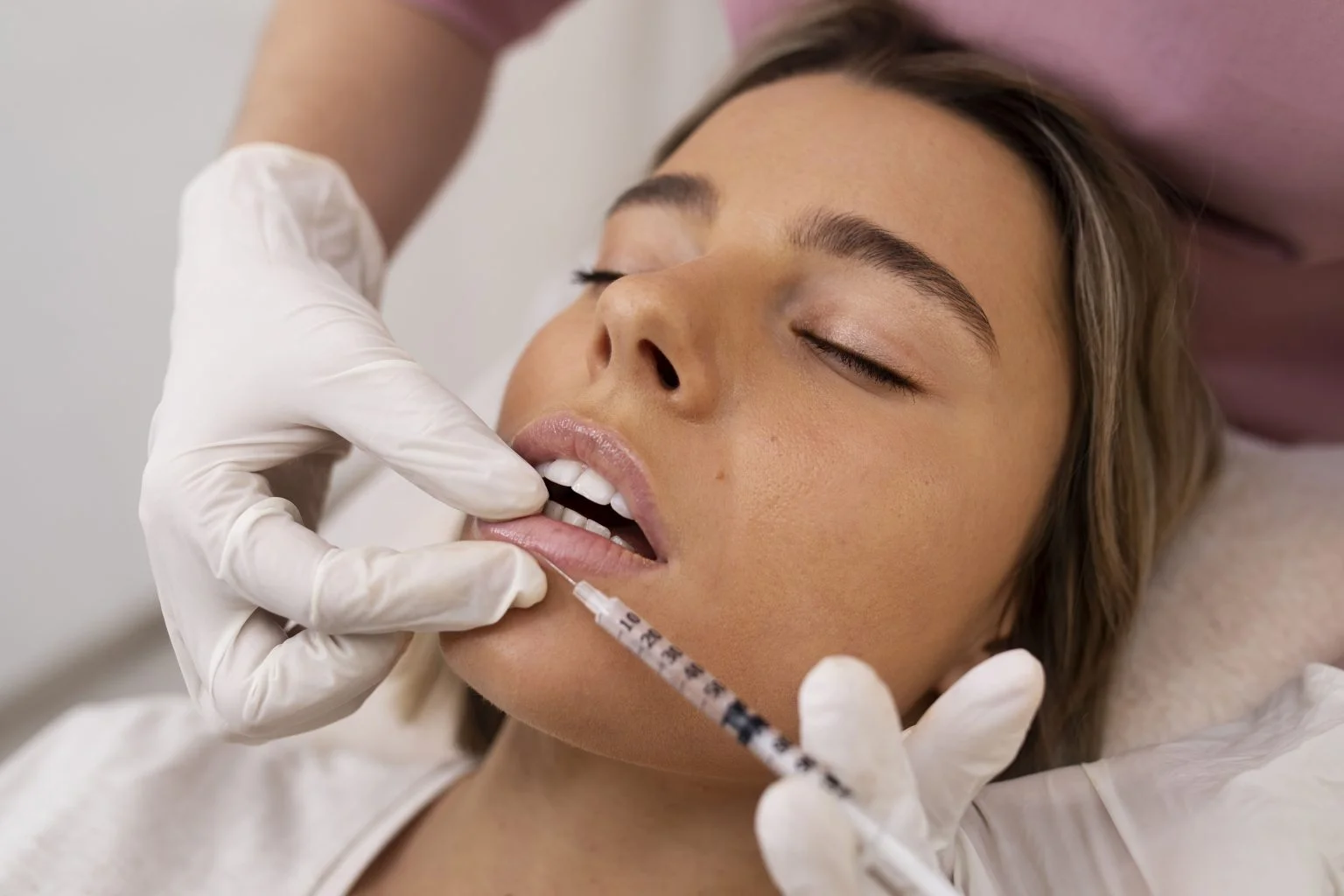 Relleno Labial